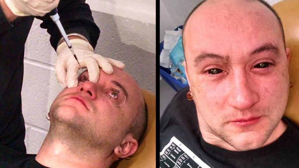Man Has Night Vision Injected Into His Eyeballs-1