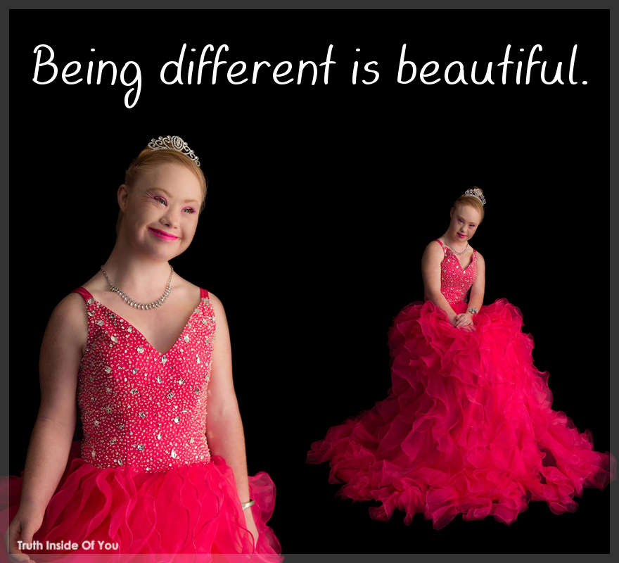 Being different is beautiful.