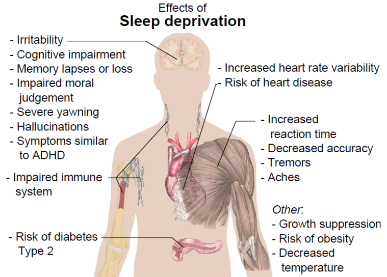 Effects of Sleep Deprivation