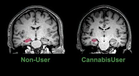 cannabis user - non user