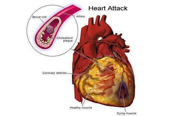 drinking water on empty stomach