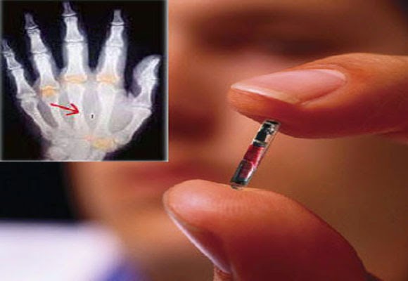 Microchip Implant