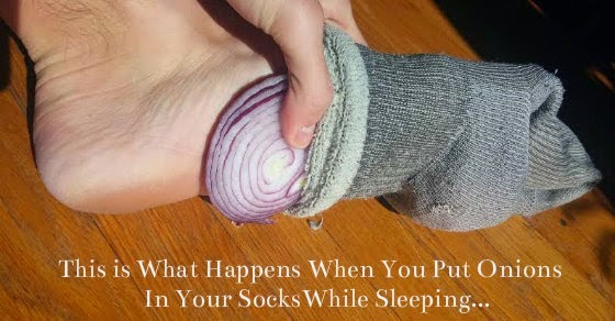 Put Onions in Your Socks