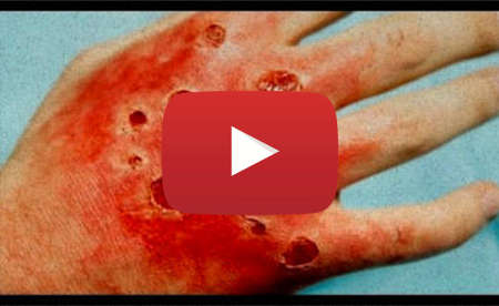 10 Diseases That Will Kill You In A Day