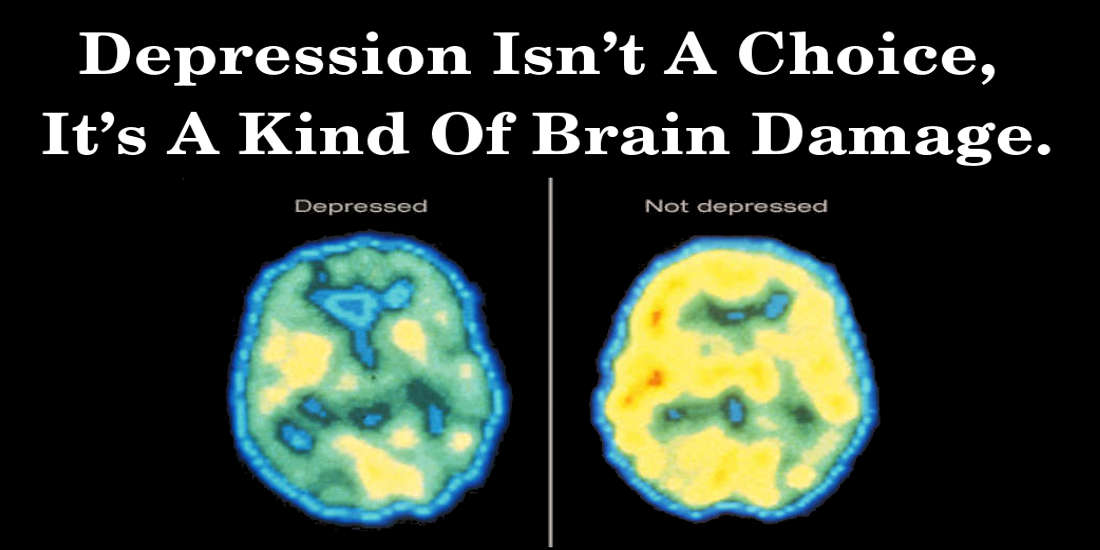 Depression Isn’t A Choice, It’s A Kind Of Brain Damage.