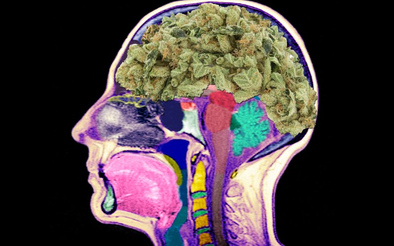 Cannabis-Brain