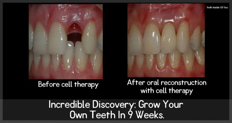 Incredible Discovery: Grow Your Own Teeth In 9 Weeks.