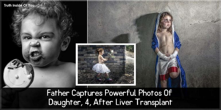 Father Captures Powerful Photos Of Daughter, 4, After Liver Transplant