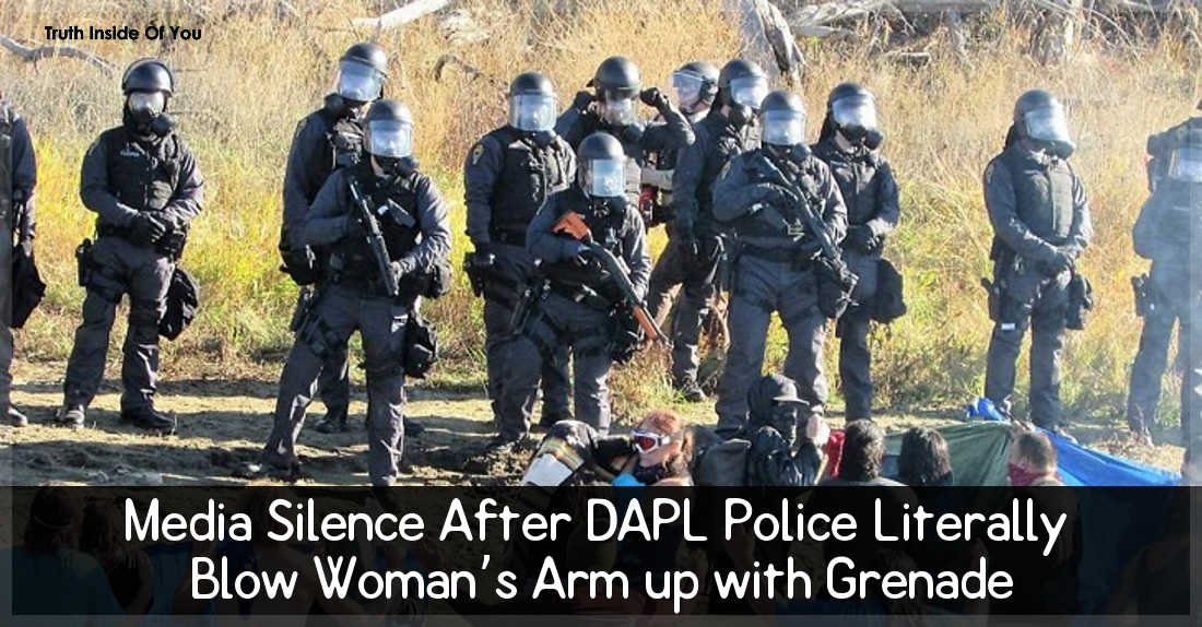Media Silence After DAPL Police Literally Blow Woman’s Arm up with Grenade