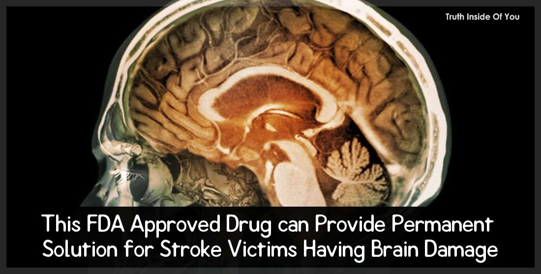 This FDA Approved Drug can Provide Permanent Solution for Stroke Victims Having Brain Damage