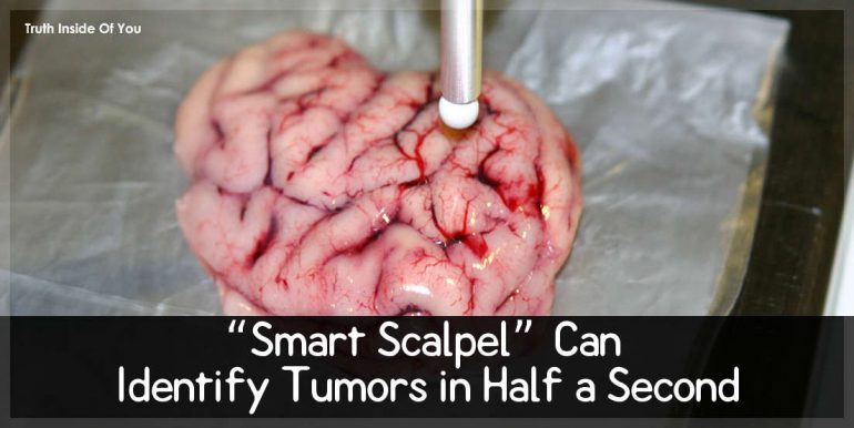 “Smart Scalpel” Can Identify Tumors in Half a Second