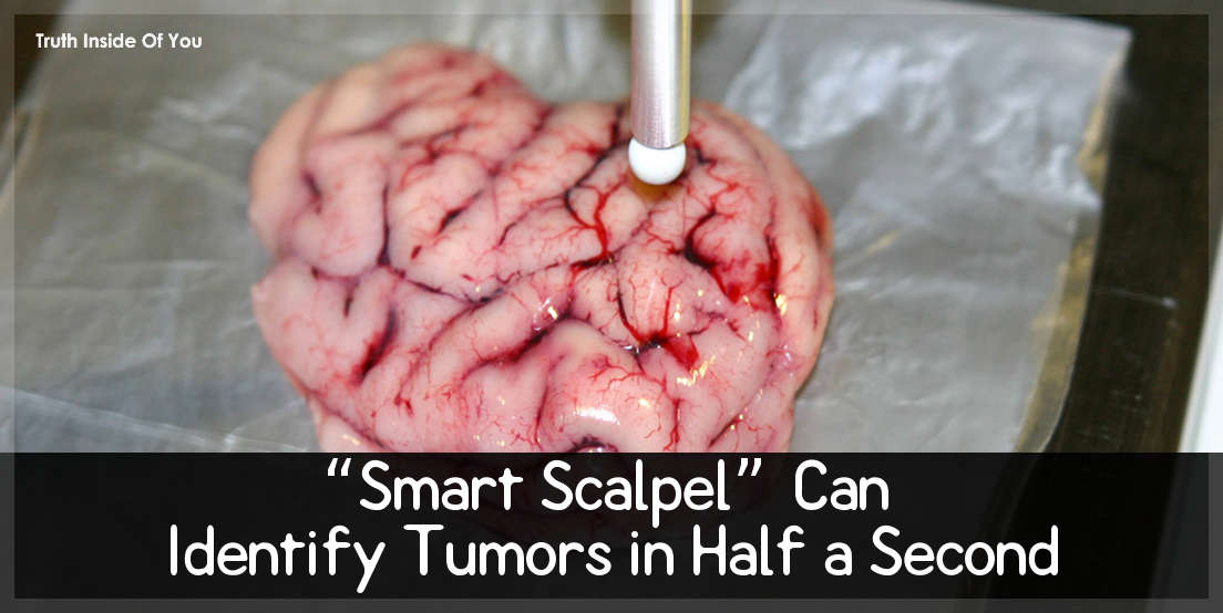 “Smart Scalpel” Can Identify Tumors in Half a Second