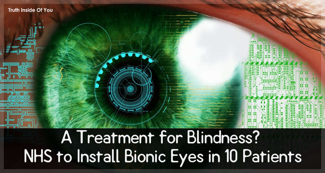 A Treatment for Blindness? NHS to Install Bionic Eyes in 10 Patients