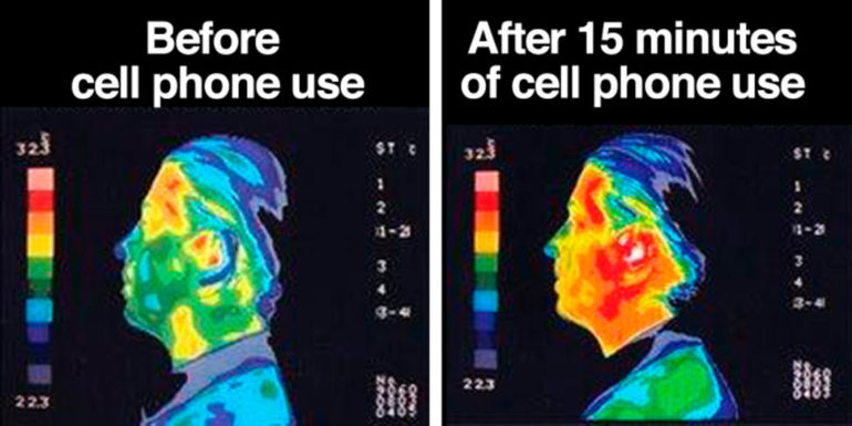 Cancer Can be Caused by Cell Phone Radiation.