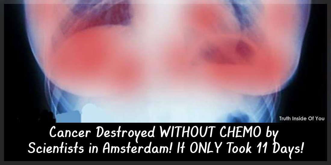 Cancer Destroyed Without Chemo by Scientists in Amsterdam! It Only Took 11 Days!
