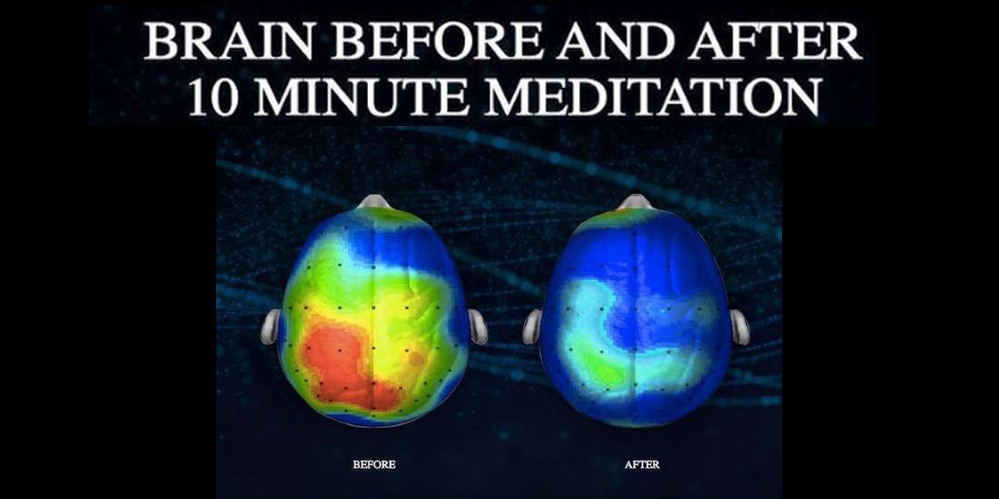 brain before and after 10 minute meditation