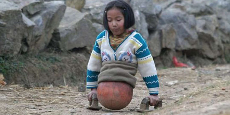 20 Powerful Images That-Capture-the-Strength-and-Beauty-of-the-Human-Spirit.1