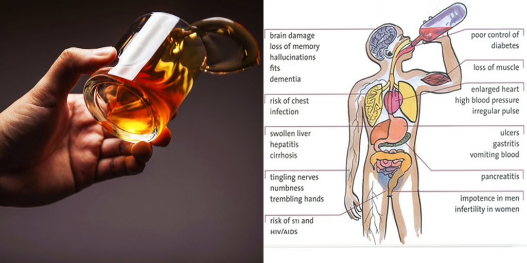 Once You Hear This Psychiatrist’s Take on Alcohol, You’ll Never Drink Again.