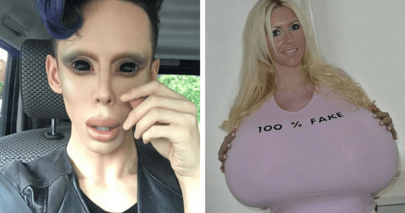11 of the Most Disturbing Body Parts That People Acquired After Plastic Surgery
