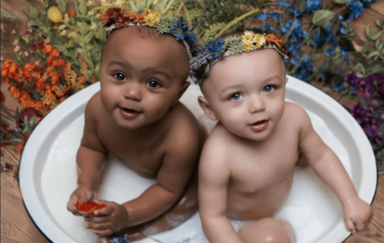 Beautiful Pictures Of The First Twin Sisters With Different Skin Colors Who Are 18 Years Old Today