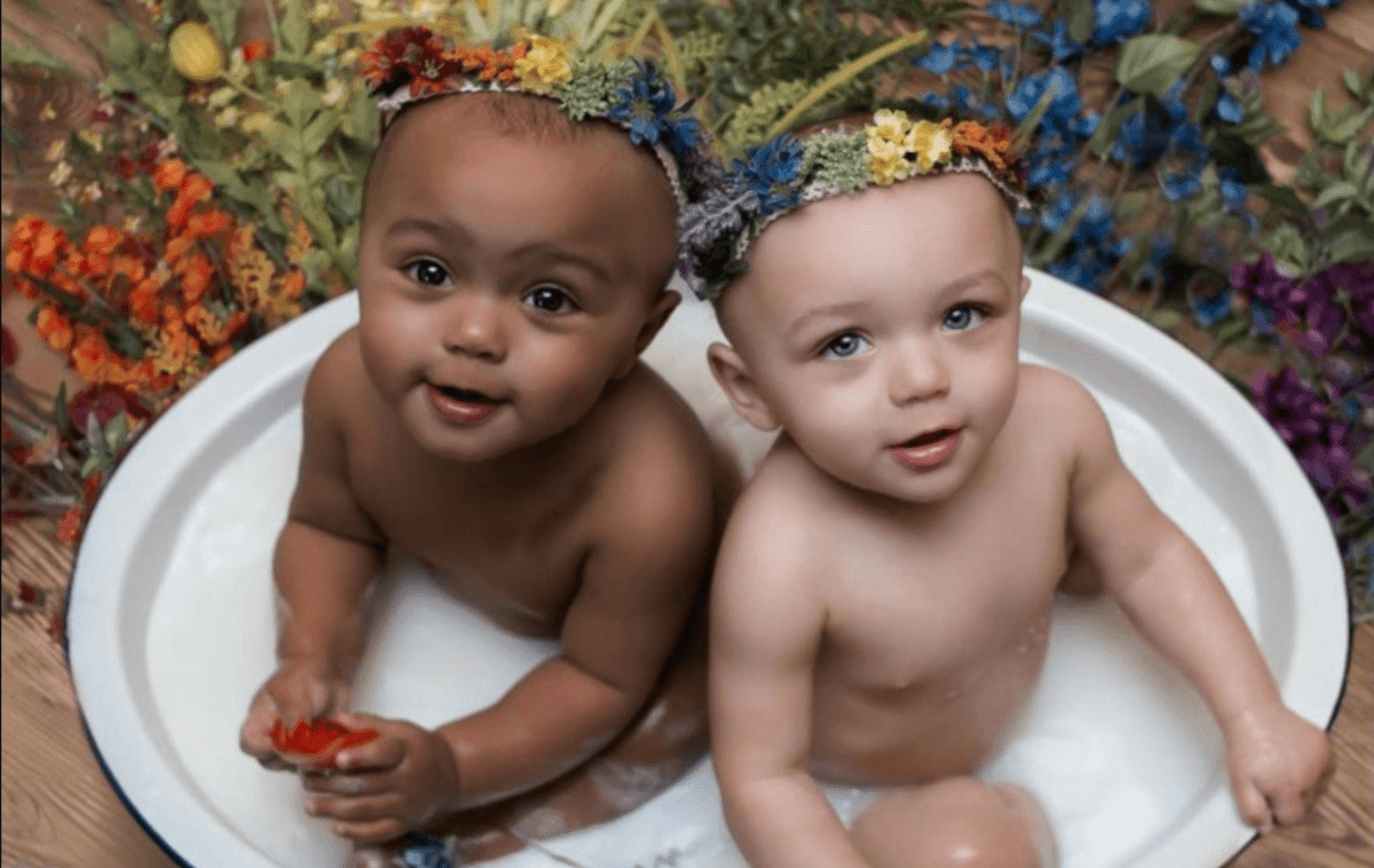 Beautiful Pictures Of The First Twin Sisters With Different Skin Colors Who Are 18 Years Old Today