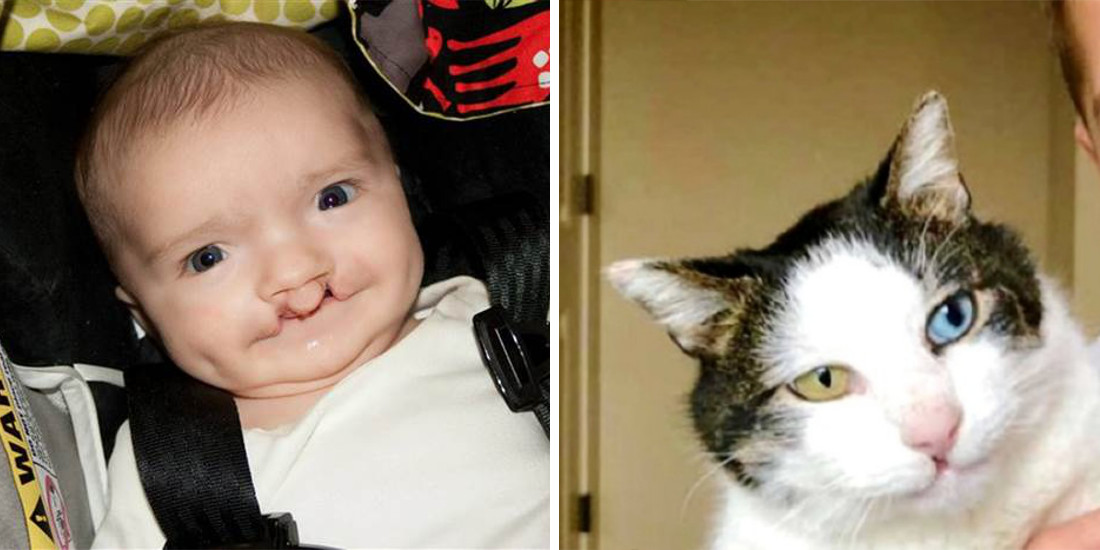 Bullied Boy Adopts Rescue Cat with Same Rare Eye Condition and Cleft Lip-5