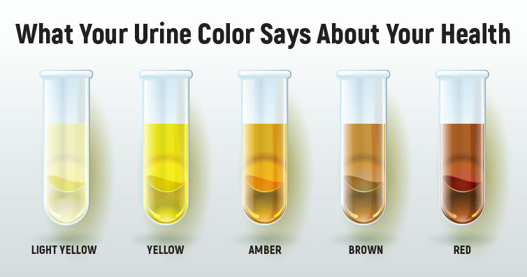 What The Color Of Your Urine Says About Your Health