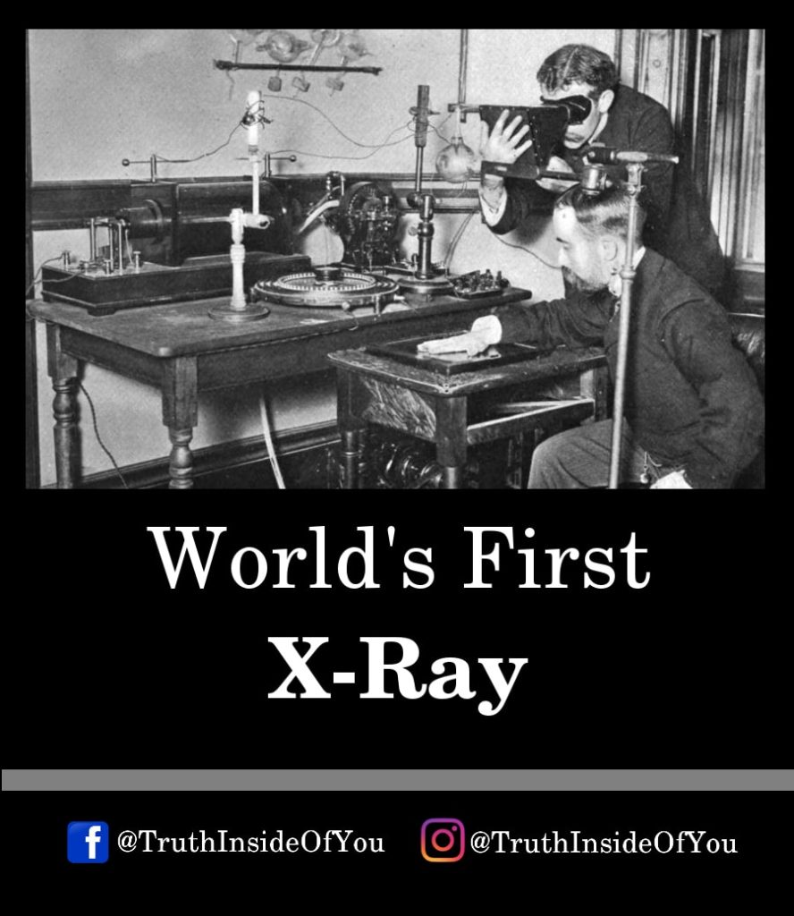 20. World's First X-Ray