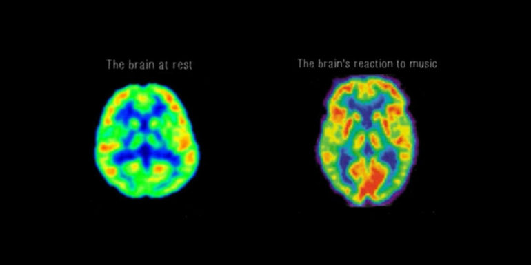 This Amazing Song Put Together By Neurosciencist That Reduces Stress by 65 Percent