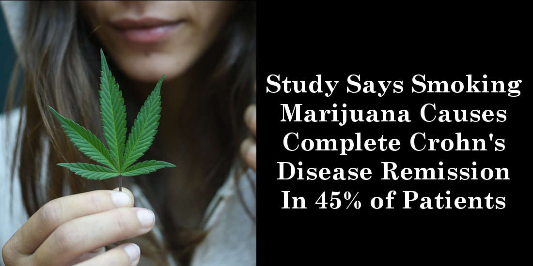 Study Says Smoking Marijuana Causes Complete Crohn’s Disease Remission In 45% of Patients