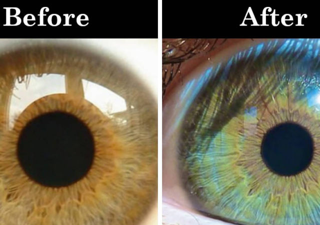 7 Things That Can Change Your Eye Color