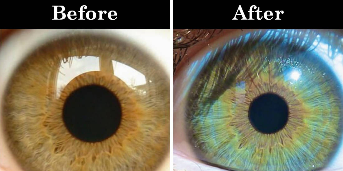 7 Things That Can Change Your Eye Color