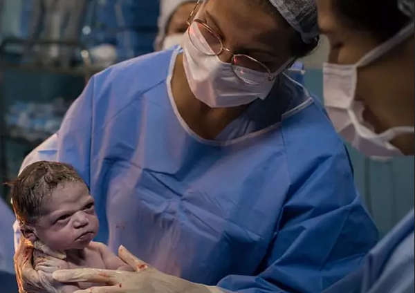 Photographer Captures Moment Newborn Baby Frowns At Doctor 1