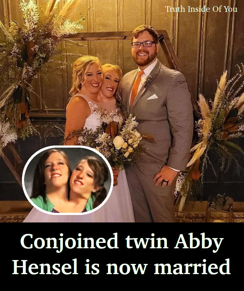 Conjoined twin Abby Hensel is now married